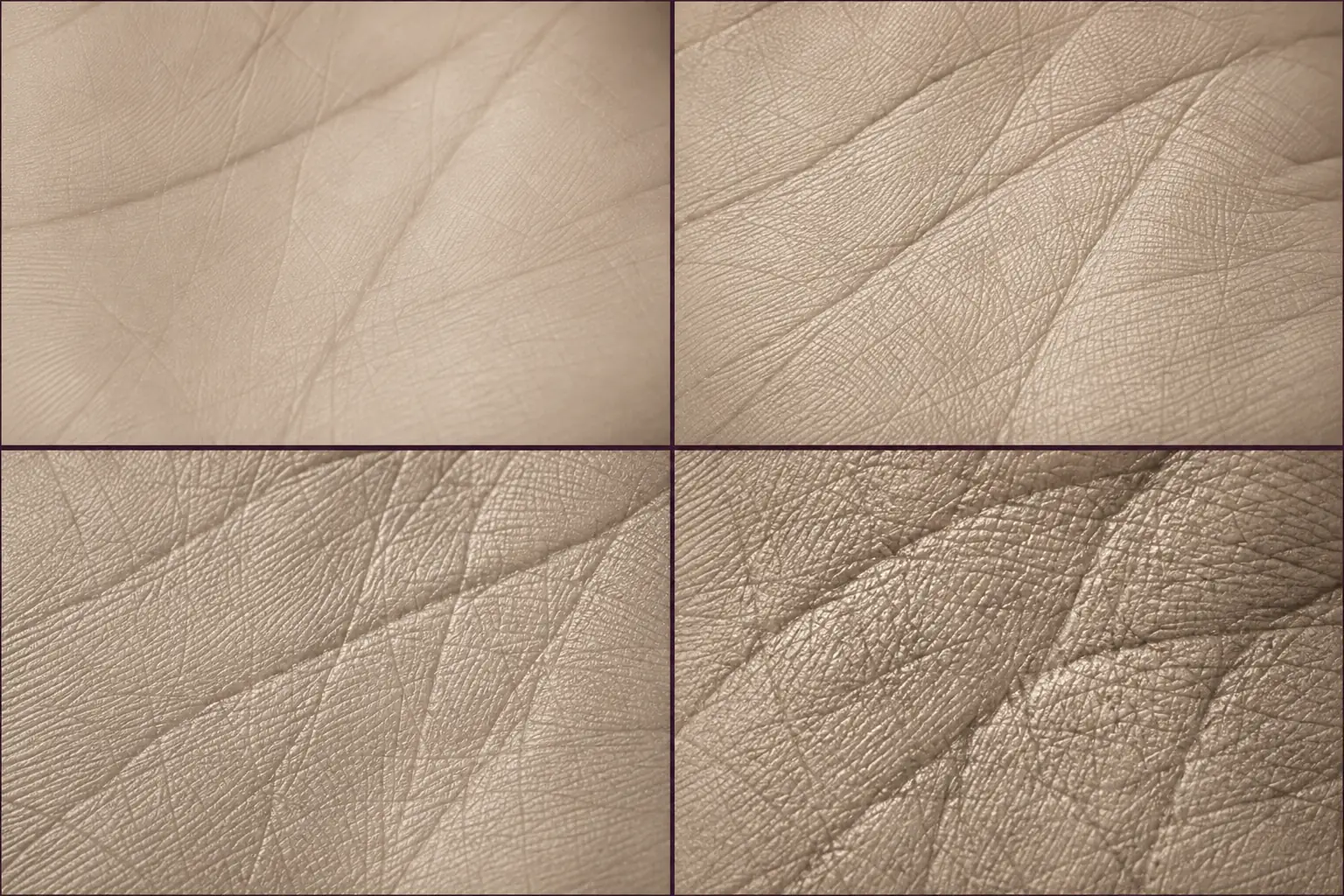 Four close-up palm photographs showing progressively stronger skin-ridge texture